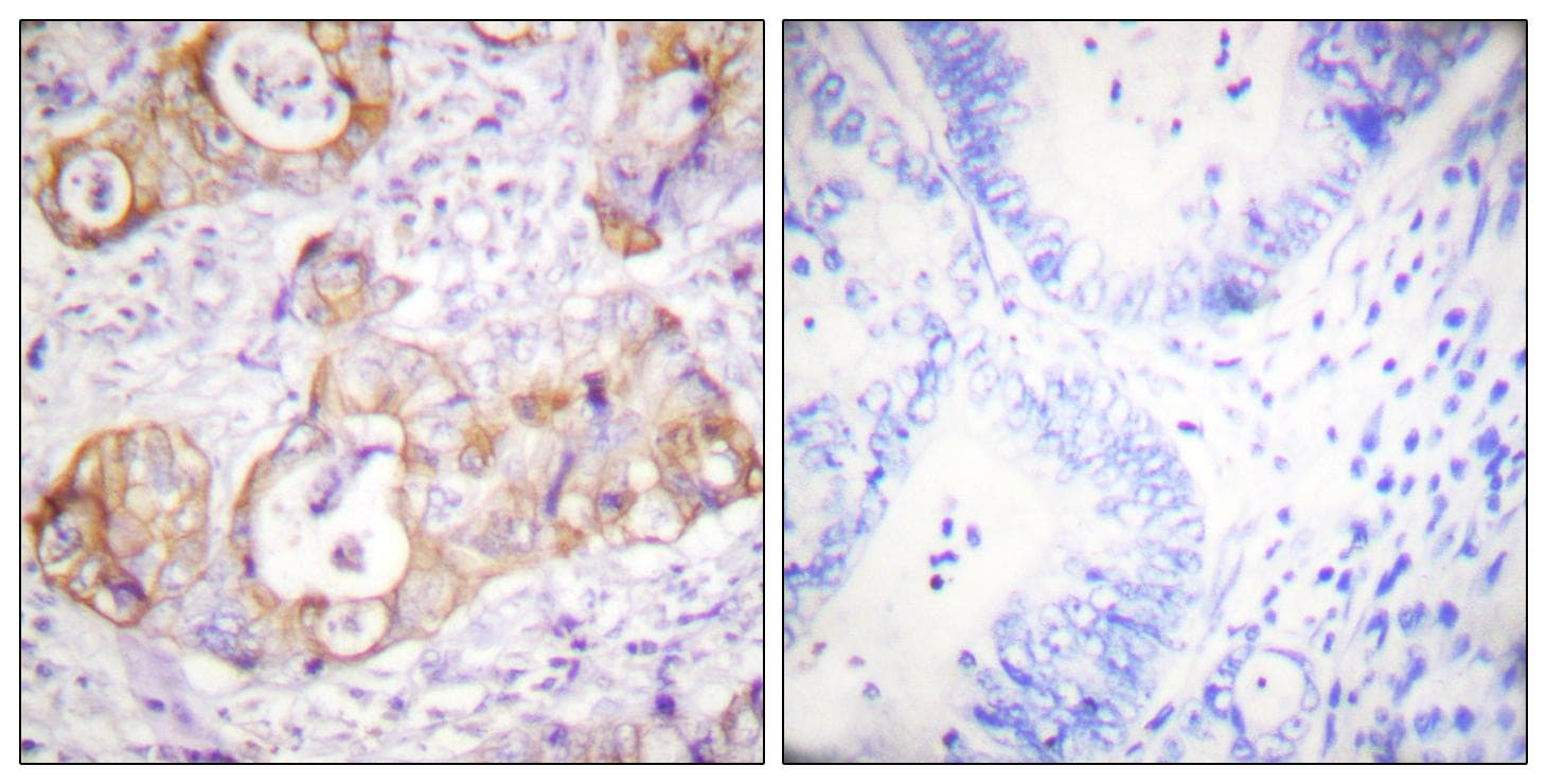 Polyclonal Rabbit anti-Human KRT8 / CK8 / Cytokeratin 8 Antibody (phospho-Ser432, IHC, IF, WB)