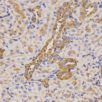 IHC-plus™ Polyclonal Rabbit anti-Human KLK5 / Kallikrein 5 Antibody (IHC, WB)