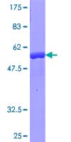 Human CRYBB1 Protein (Recombinant GST)