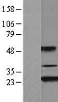 AKIRIN2 Protein (Over-Expression Lysate Myc-DDK (Flag))