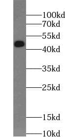 TGFB1 / TGF Beta 1 Antibody