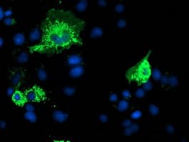 P5CR2 / PYCR2 Antibody (clone OTI2B11)
