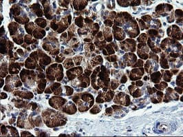 MAPK9 / JNK2 Antibody (clone OTI2H3)