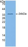 Polyclonal Rabbit anti-Human ITGB3 / Integrin Beta 3 / CD61 Antibody (FITC, aa135-377, WB)