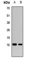 FGF21 Antibody