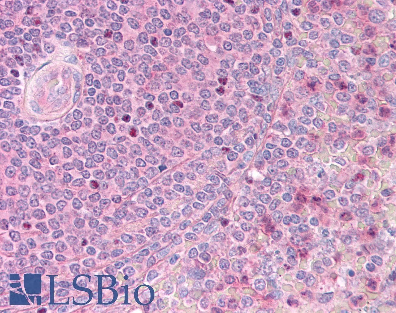IHC-plus™ HTS1 / ST5 Antibody (aa1121-1137)