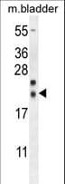 Polyclonal Rabbit anti-Human NXNL2 Antibody (aa80-108, IHC, WB)