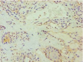 E2F6 Antibody (aa1-281)