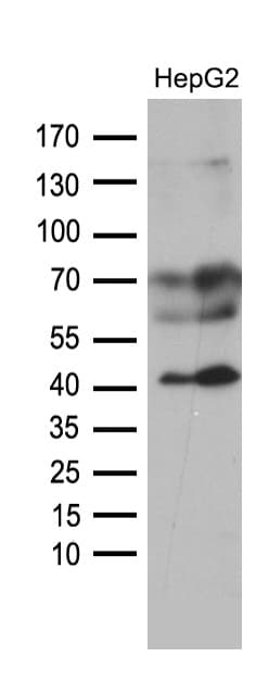 AGPAT9 / MAG1 Antibody (aa41-131, clone OTI3H3)