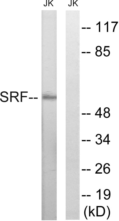 IHC-plus™ SRF / Serum Response Factor Antibody (aa41-90)