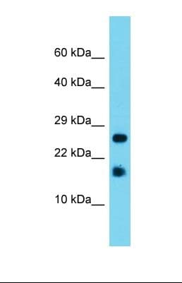 A2LD1 Antibody (C-Terminus)