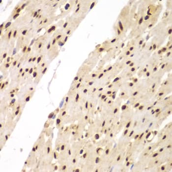 Polyclonal Rabbit anti-Human FAM48A / P38IP Antibody (IHC, IF, WB)