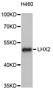 LHX2 Antibody