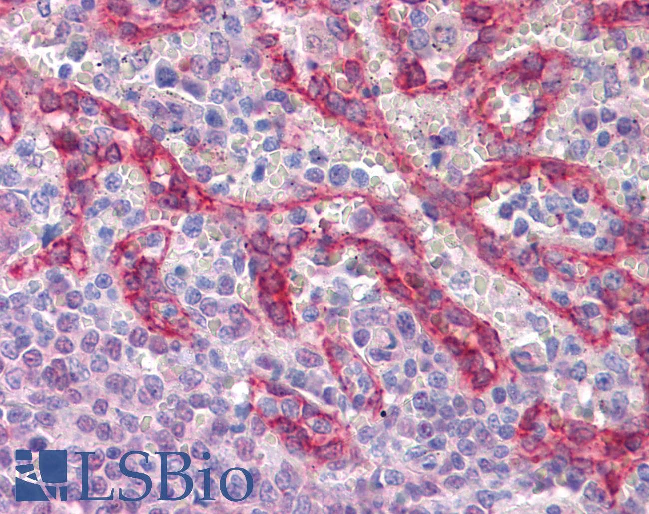 IHC-plus™ CDH1 / E Cadherin Antibody (clone 3F4)