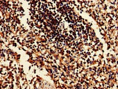 Polyclonal Rabbit anti-Human EIF2AK1 Antibody (IHC, IF, WB)