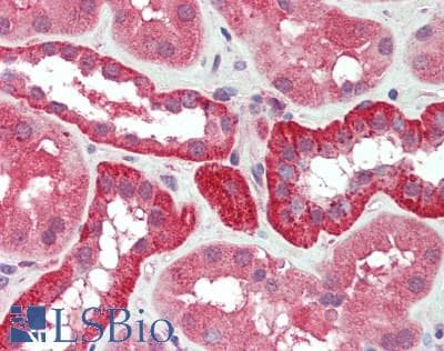 YKL39 / CHI3L2 Antibody
