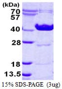 Human OTC Protein (Recombinant His)