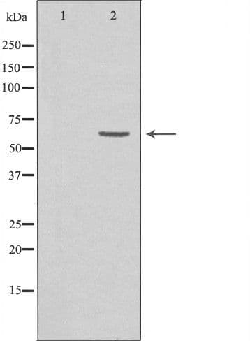 Polyclonal Rabbit anti-Human GRK7 / GPRK7 Antibody (IF, WB)