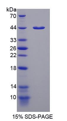 Rat P4HA1 Protein (Recombinant His-S)