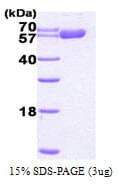 Human HSPD1 / HSP60 Protein (Recombinant His)