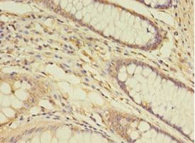 THRA / THR Alpha Antibody (aa1-490, Biotin)