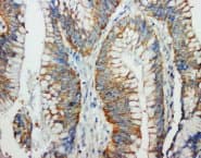 FASLG / Fas Ligand Antibody (C-Terminus)