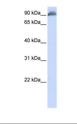 Band 4.1 / EPB41 Antibody (aa74-123)