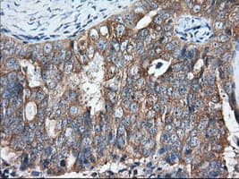 GORASP1 / GRASP65 Antibody (clone OTI5G8)