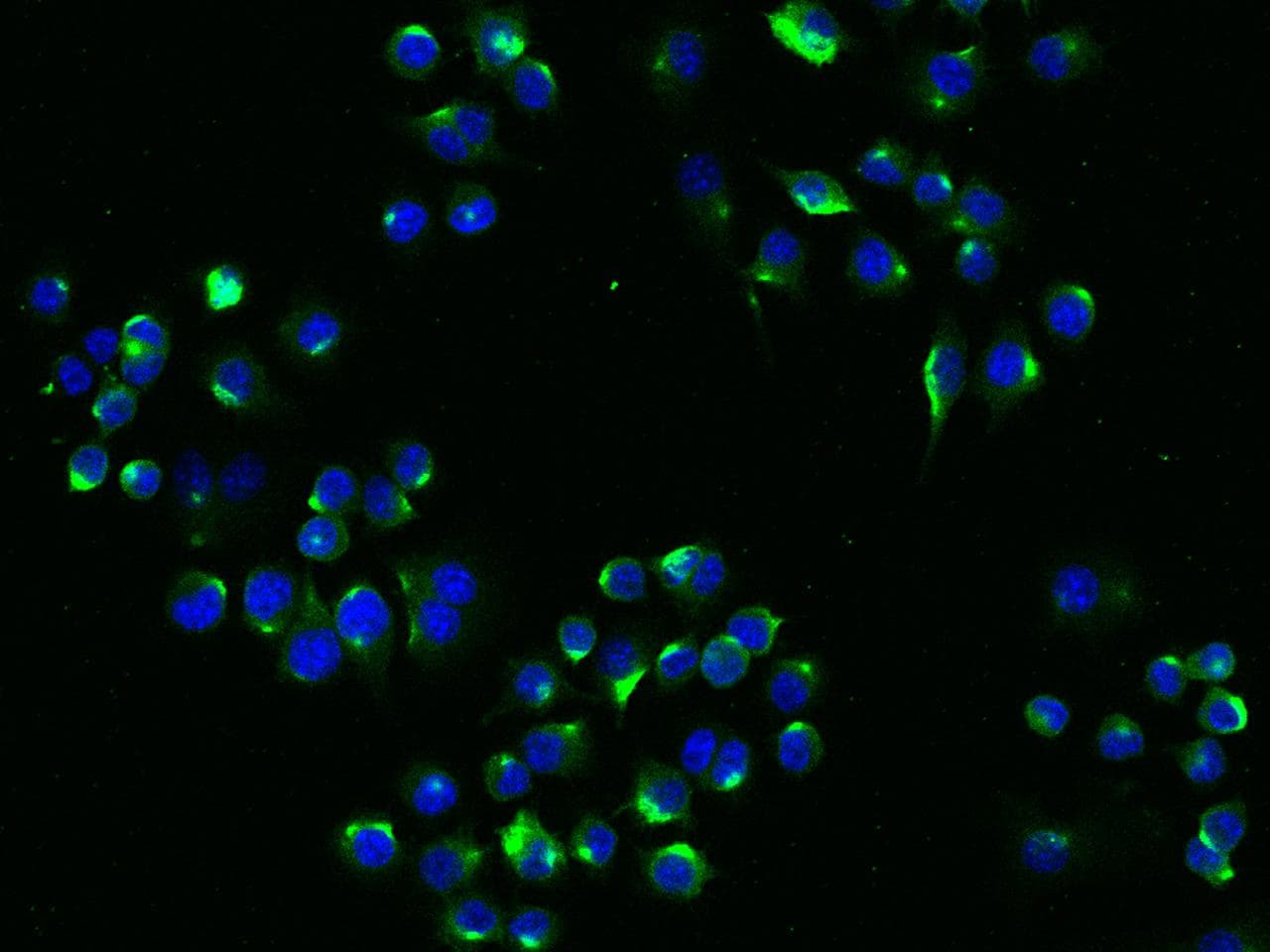 LDLR / LDL Receptor Antibody (aa1-790, clone 004, Preservative Free)