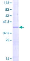 Human NDUFS5 Protein (Recombinant GST)