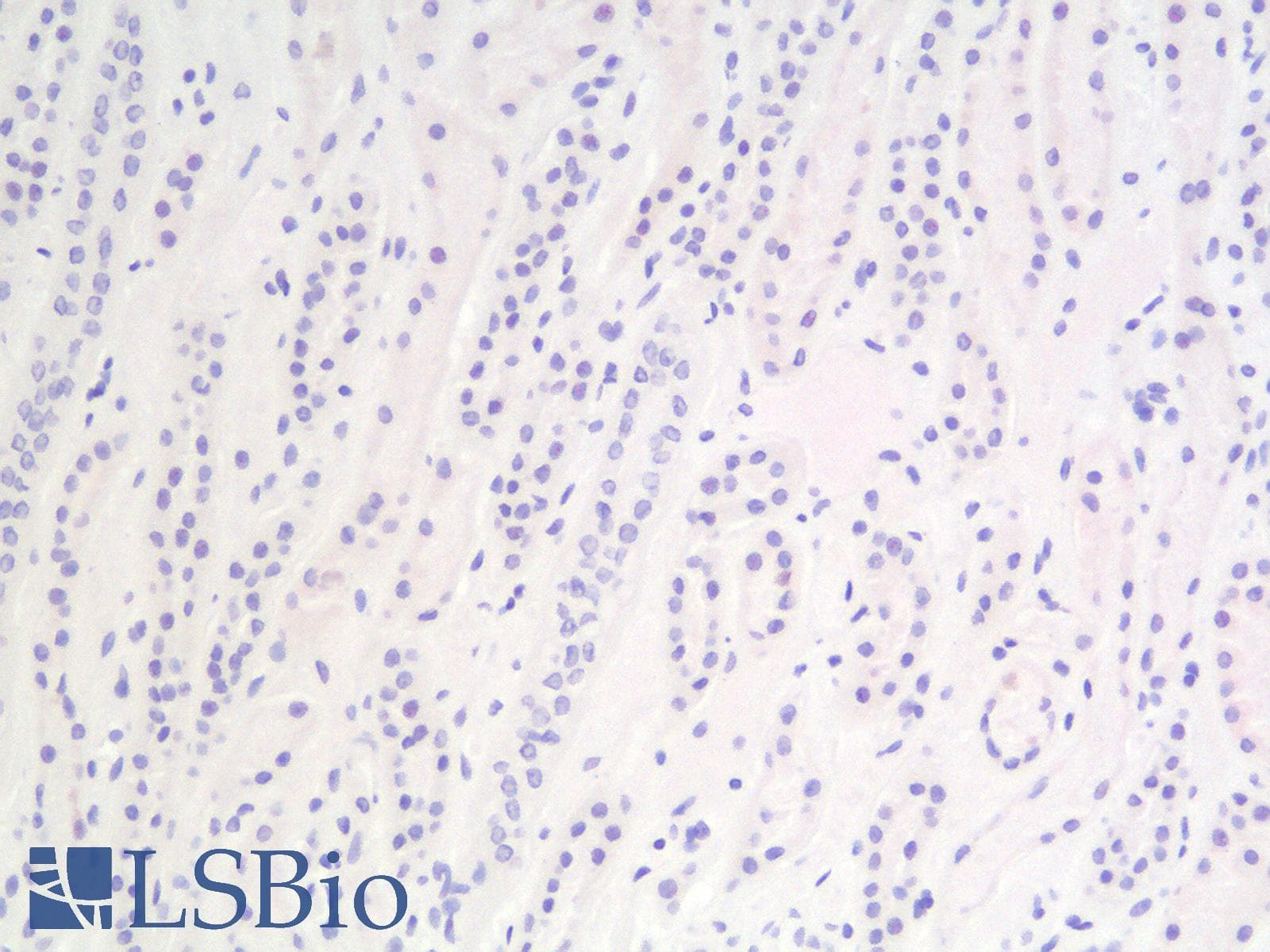 IHC-plus™ Recombinant Monoclonal Rabbit anti-Human CALD1 / Caldesmon Antibody (clone CALD1/1424R, IHC)