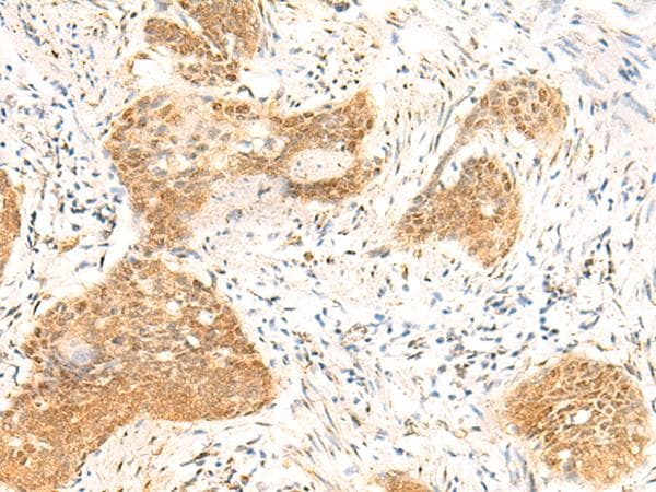 Polyclonal Rabbit anti-Human TBPL1 / TRF2 Antibody (IHC)