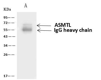 ASMTL Antibody