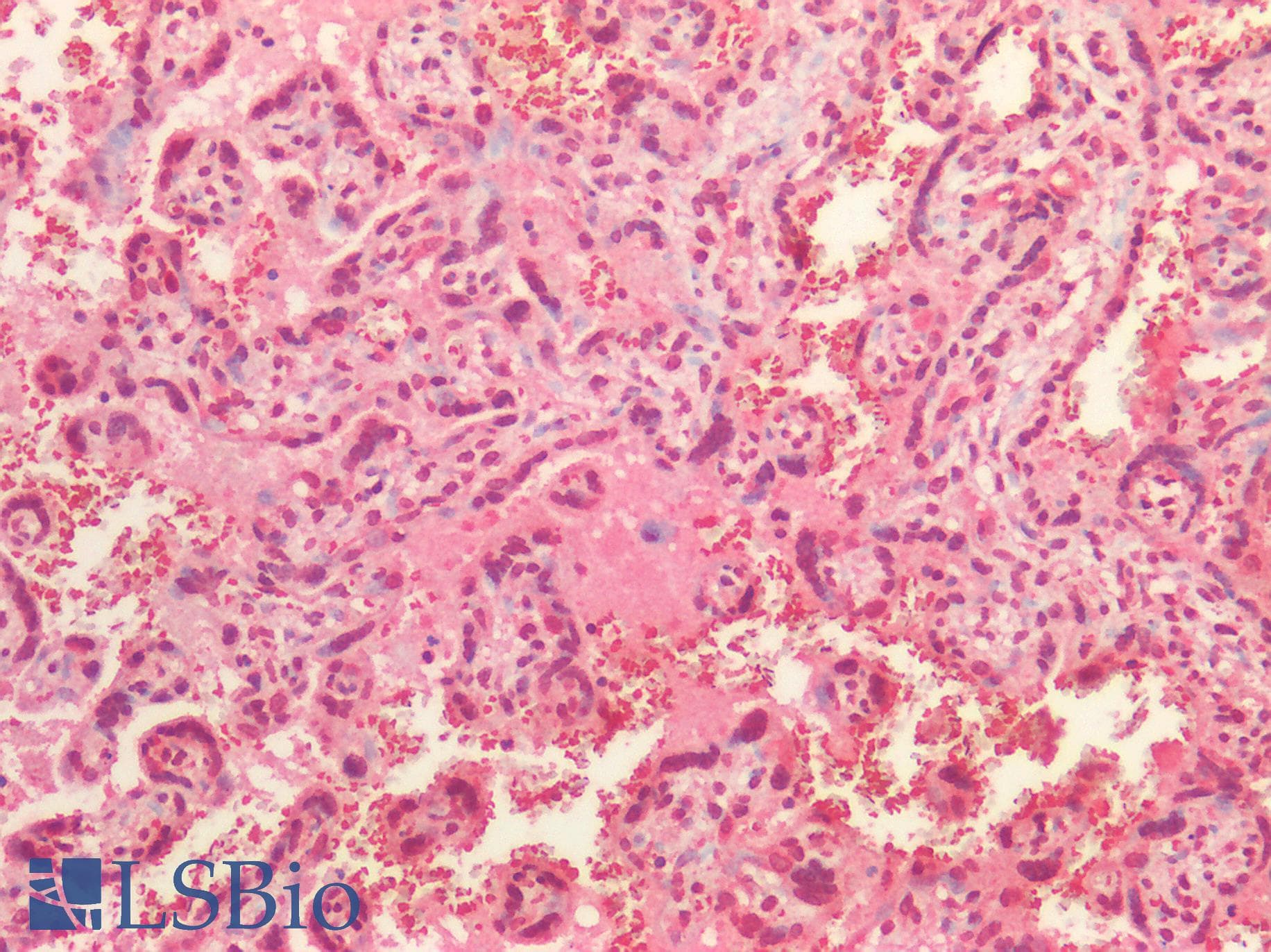 IHC-plus™ STUB1 / CHIP Antibody
