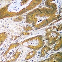 TP53 / p53 Antibody (N-Terminus)