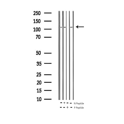 RB1 / Retinoblastoma / RB Antibody (phospho-Ser795)
