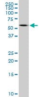 PathPlus™ Peripherin Antibody (aa374-471, clone 3B3)