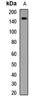 Polyclonal Rabbit anti-Human ZFYVE9 / SARA Antibody (WB)