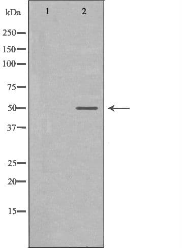 TP / Thymidine Phosphorylase Antibody