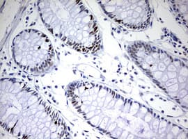 TOP2A / Topoisomerase II Alpha Antibody (aa1100-1531, clone OTI2A9)