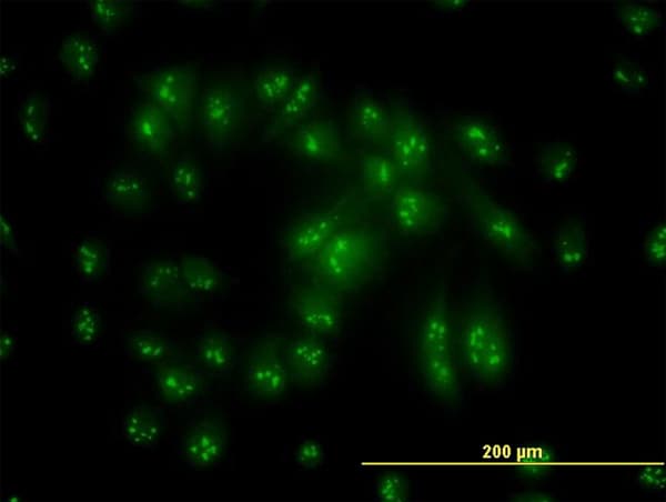 Monoclonal Mouse anti-Human PSMC6 Antibody (clone 2C4, IF, WB)