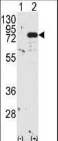 Polyclonal Rabbit anti-Human PRKCB / PKC-Beta Antibody (aa303-334, IHC, WB)
