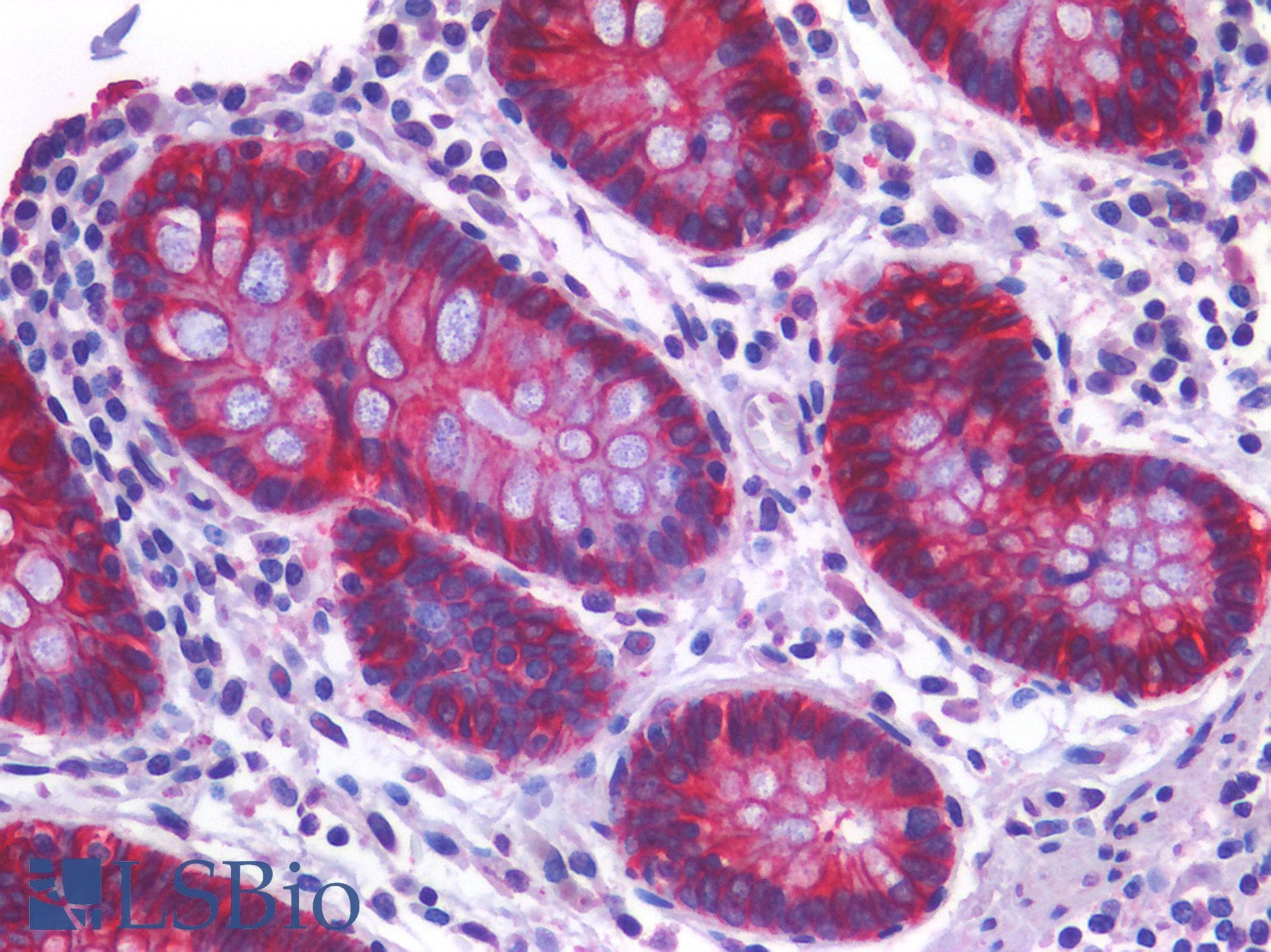 PathPlus™ CDH17 / Cadherin 17 Antibody (clone 3H2)