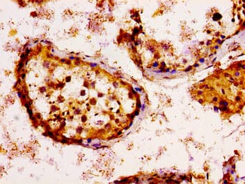 Polyclonal Rabbit anti-Human KSR2 Antibody (IHC, IF)