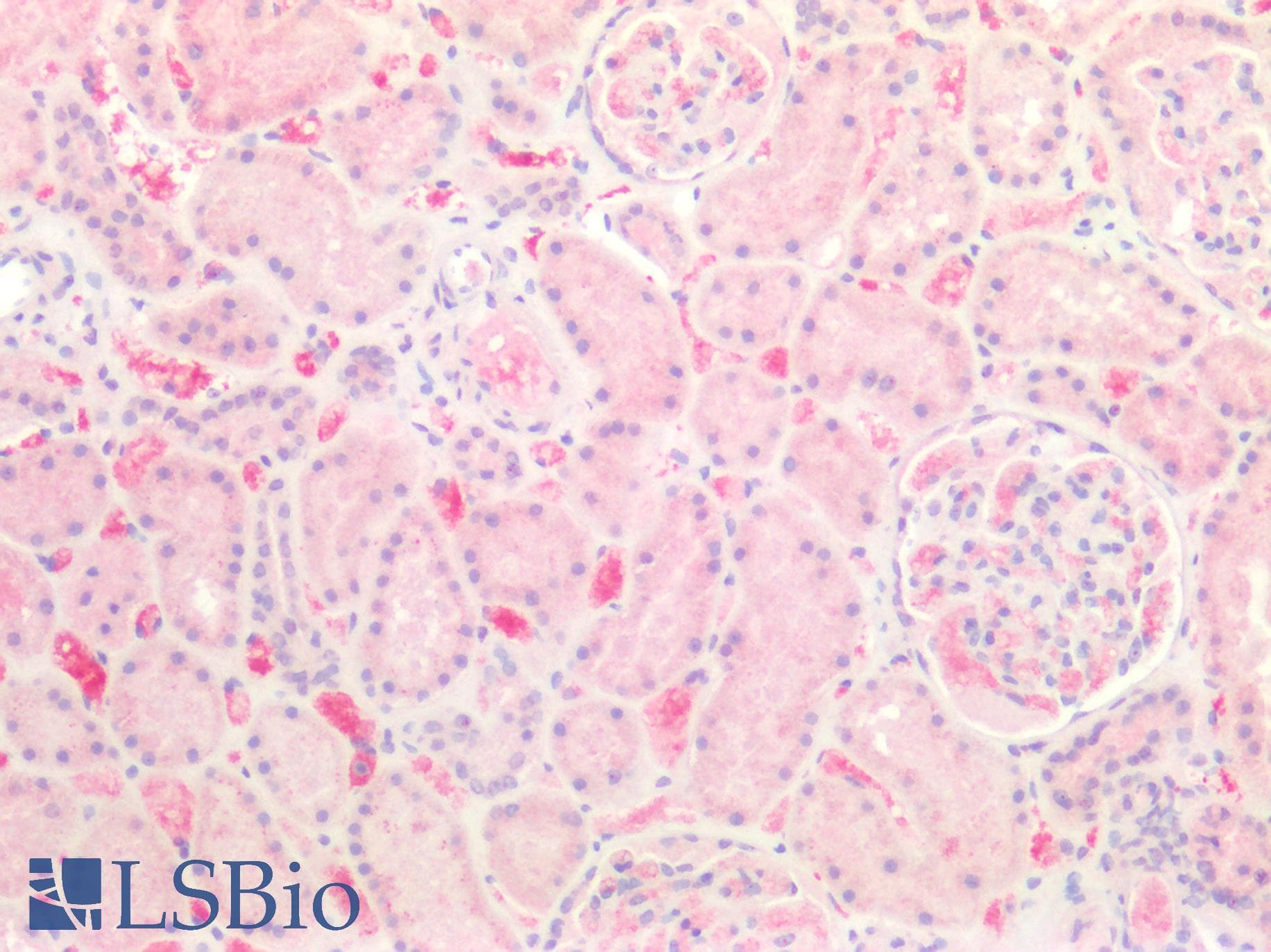 IHC-plus™ CALML3 Antibody