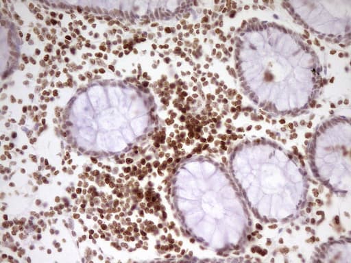 Monoclonal Mouse anti-Human SP110 Antibody (clone OTI4C1, aa232-521, IHC, WB)