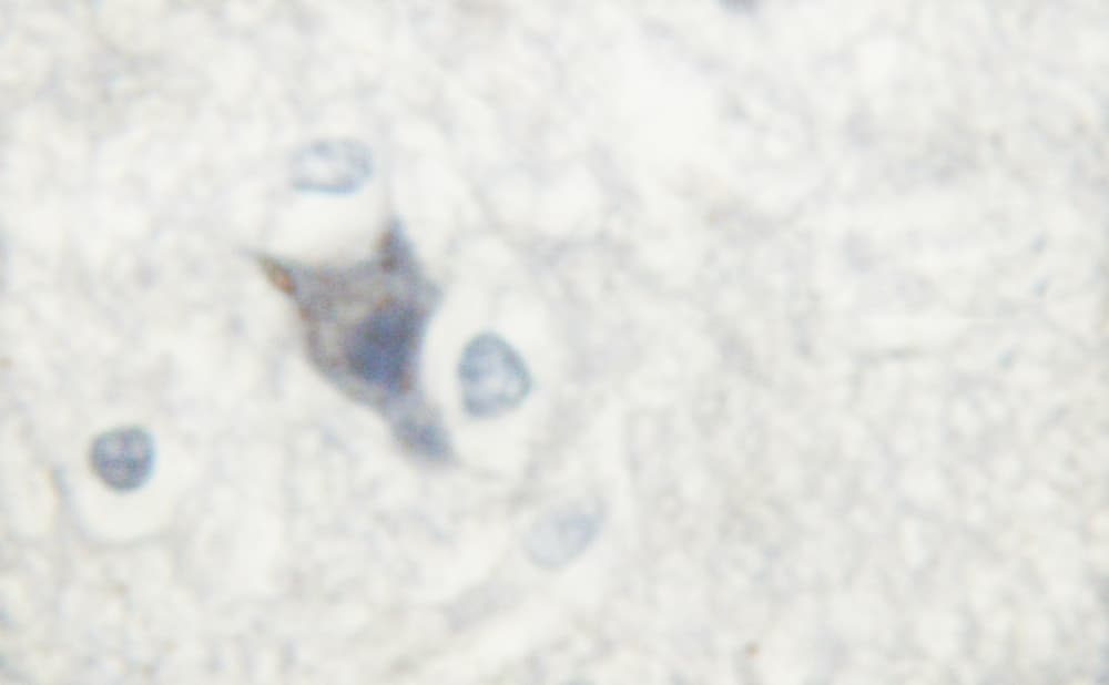 NOS1 / nNOS Antibody (phospho-Ser852)