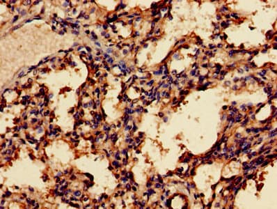 Polyclonal Rabbit anti-Human MAGEA8 Antibody