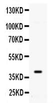 Polyclonal Rabbit anti-Human ADK / Adenosine Kinase Antibody (IHC, WB)