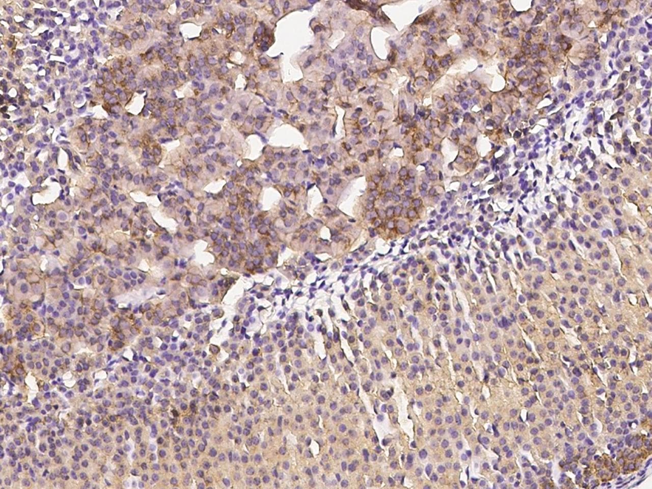 Polyclonal Rabbit anti-Mouse CLTC / Clathrin Heavy Chain Antibody (Preservative Free, IHC, WB)